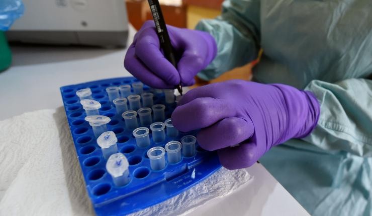 Laboratory samples for vaccine development Laboratory samples for vaccine development
