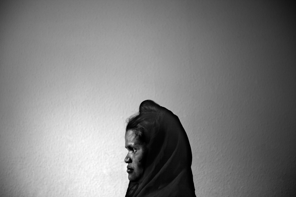 Tasmina Begum has four kids. She lived in the camp for decades with her family and husband. Life was stressful and painful there. Even after coming to Bradford for seven months, she is still has trauma. Tasmina Begum has four kids. She lived in the camp for decades with her family and husband. Life was stressful and painful there. Even after coming to Bradford for seven months, she is still has trauma.