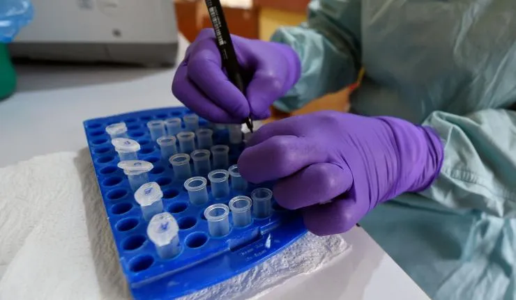 Laboratory samples for vaccine development