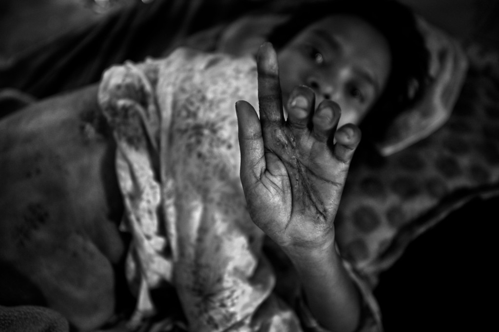 Tayeba Begum wanted to save her daughter from her stepfather who tried to rape the twelve-year-old Shahara Khatun several times. Failing to do so, Abul Khaher took revenge. He stabbed Tayeba seven times. A few days after this photograph was taken, Tayeba died in a hospital in Dhaka. Tayeba Begum wanted to save her daughter from her stepfather who tried to rape the twelve-year-old Shahara Khatun several times. Failing to do so, Abul Khaher took revenge. He stabbed Tayeba seven times. A few days after this photograph was taken, Tayeba died in a hospital in Dhaka.