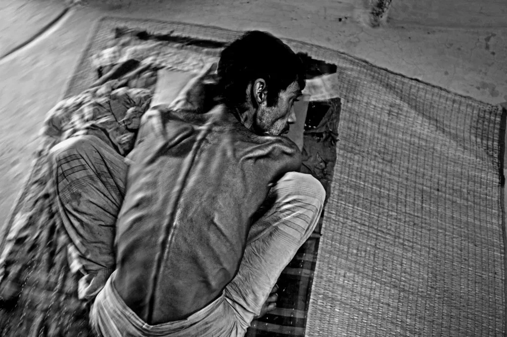 Ali Mia suffered from an unknown disease. When he went to the hospital he was told, “We do not have any treatment for you. But if you can go to London then they might help you.” Ali Mia came back to the camp and waited to die. He had no medical assistance or medicine for months. Twenty-four hours after this image was taken, Ali Mia died.